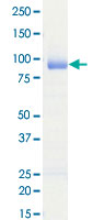 Loading 1 &mu;g protein in SDS-PAGE